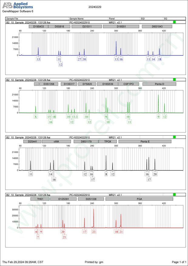 SACC-83(人涎腺腺样囊性癌细胞)