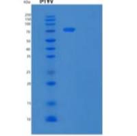 人血管细胞粘附1(Vascular Cell Adhesion 1)重组蛋白