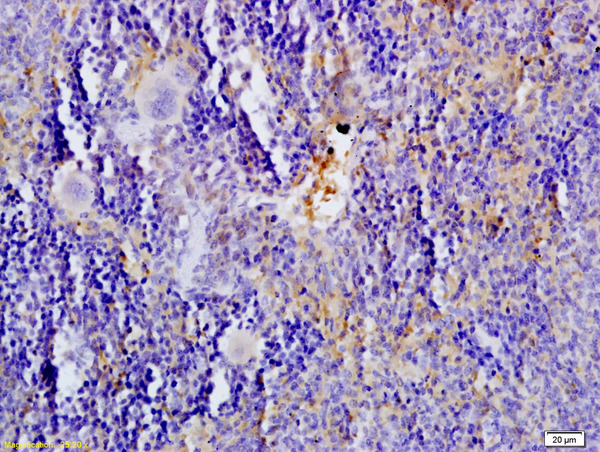 SLC6A4 Antibody (OABF00859) in Rat spleen tissue using Immunohistochemistry