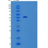 人生精蛋白Ⅰ(SEMG1)重组蛋白C-6His