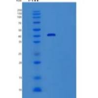 人生精蛋白Ⅰ(SEMG1)重组蛋白C-6His