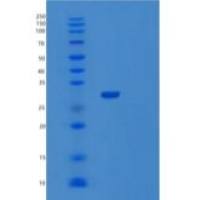 人R-脊椎蛋白1(RSPO1)重组蛋白His tag
