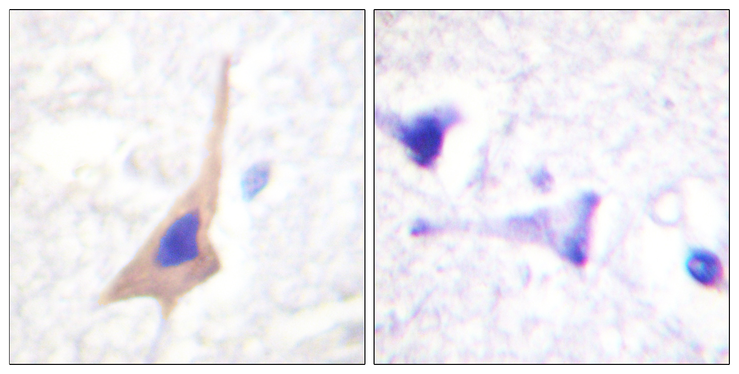 TPH1 Antibody (Phospho-Ser58) (OAAF00209) in human brain using Immunohistochemistry.