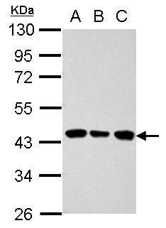 ALDOB Antibody (OAGA01567) in 293T, A431, Hela using Western Blot