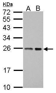 BAG2 Antibody (OAGA01911) in A431 using Western Blot