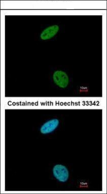 CDK6 Antibody (OAGA02236) in Paraformaldehyde-fixed Hela using Immunofluorescence