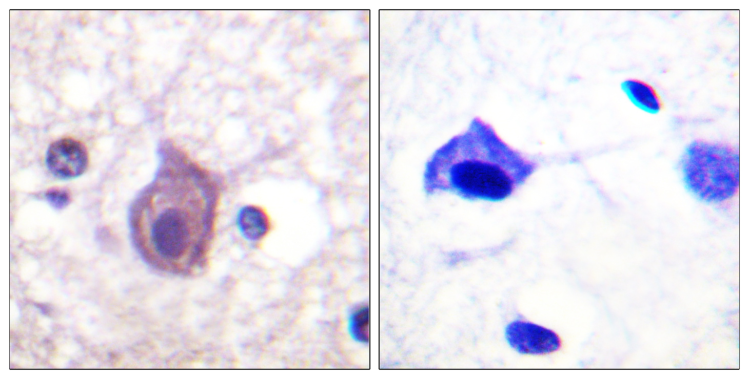 CD4 Antibody (Phospho-Ser433) (OAAF07533) in Paraffin-embedded human brain using Immunohistochemistry