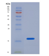 人半乳糖凝集素1(GAL1)重组蛋白