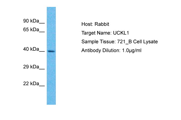 UCKL1 Antibody - N-terminal region (ARP71935_P050) in Human 721_B using Western Blot