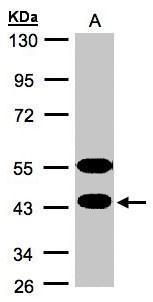 CABS1 Antibody (OAGA02814) in MOLT4 using Western Blot