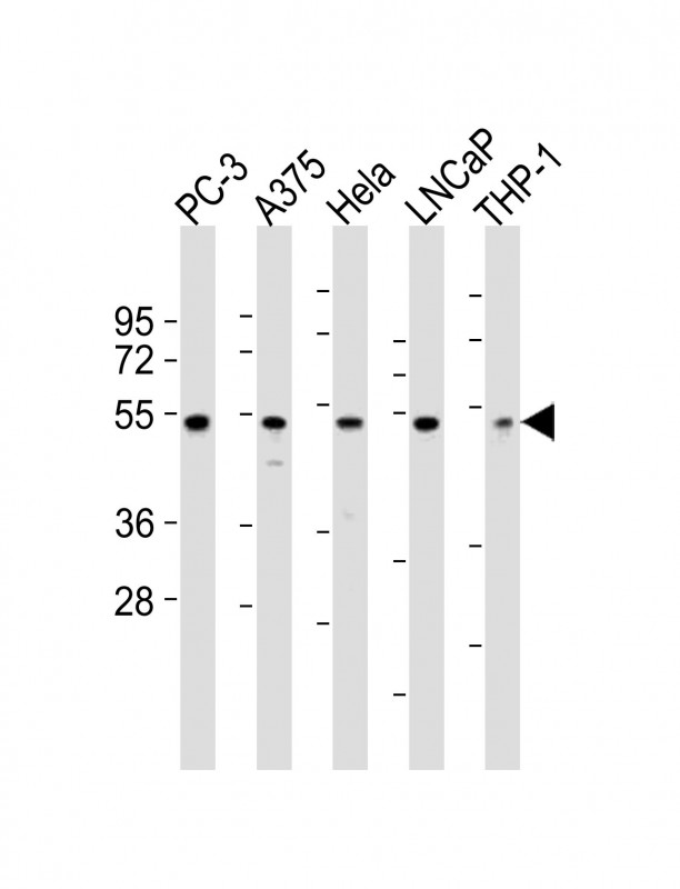 NFKBIE Antibody - N-terminal region (OAAB19308) in PC-3 whole cell lysates, A375 whole cell lysates, Hela whole cell lysates, LNCaP whole cell lysates, THP-1 whole cell lysates using Western Blot