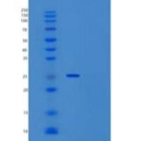 小鼠干扰素γ受体1/干扰素γ R1/CD119重组蛋白