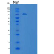 人胶质细胞系来源神经营养因子受体α2(GFRa2)重组蛋白C-Fc-6His