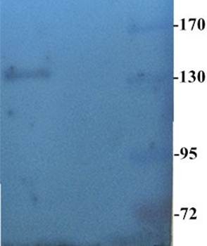 CD163 Antibody (OABI00014) in Rat lung tissue using Western Blot
