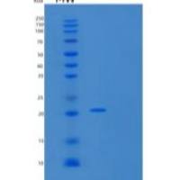人OX40L受体重组蛋白