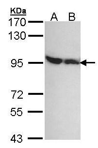DDX1 Antibody - middle region (OAGA02498) in A431 using Western Blot