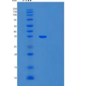 人Carbonic Anhydrase 8/CA8重组蛋白C-6His产品图