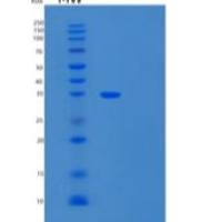 人Carbonic Anhydrase 8/CA8重组蛋白C-6His