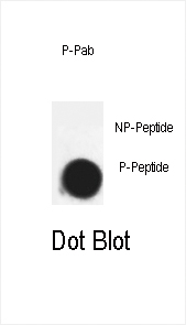 Phospho-CDK7-T170 Antibody (OAAB16026) in nitrocellulose membrane using Dot Blot