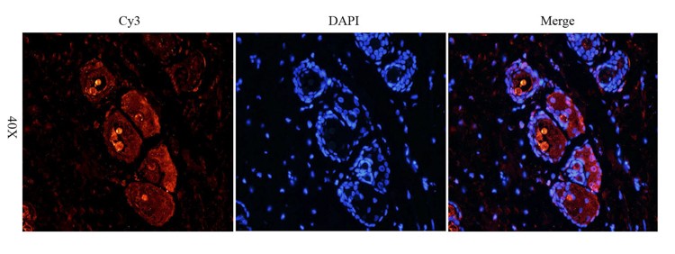 VEGF165 Antibody (OABI00020) in Rat skin tissue using Immunofluorescence