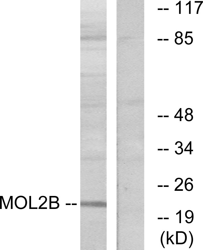 MOB3B Antibody (OAAF02520) in COLO using Western blot.