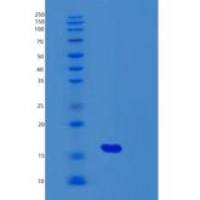 人碱性成纤维细胞生长因子(FGF2)重组蛋白Gly132-Ser288