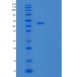 小鼠疱疹病毒进入介质重组蛋白