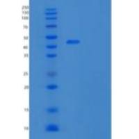 小鼠疱疹病毒进入介质重组蛋白