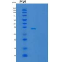 人膜辅蛋白(MCP)重组蛋白C-6His