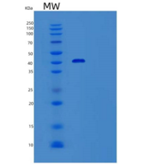 人生精蛋白Ⅰ(SEMG1)重组蛋白C-6His