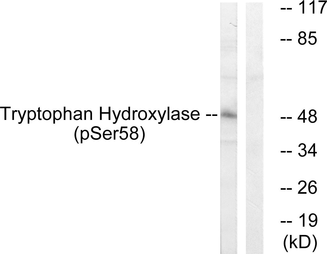TPH1 Antibody (Phospho-Ser58) (OAAF00209) in 293 using Western blot.