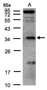 FN3KRP Antibody (OAGA02447) in H1299 using Western Blot