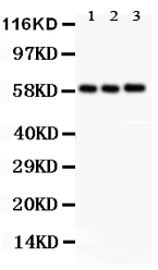 SLC2A9 Antibody - C-terminal region (OABB01329) in Rat Liver Tissue Lysate, A549 Whole Cell Lysate, HELA Whole Cell Lysate using Western Blot