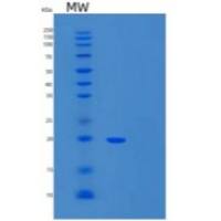 小鼠t细胞免疫球蛋白和粘蛋白结构域-3重组蛋白