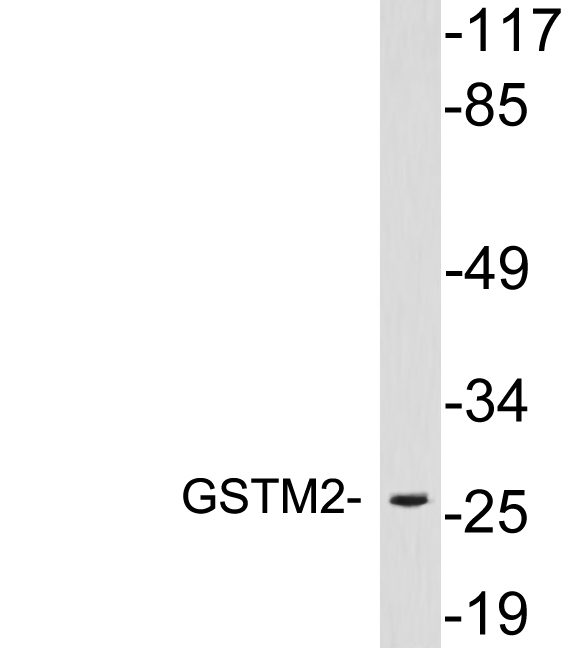 GSTM2 Antibody (OAAF05783) in 293 using Western blot.