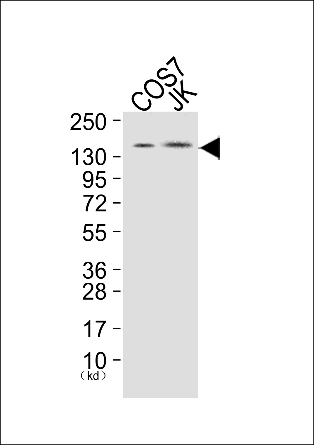PLCG1 Antibody (OAAB18291) in COS7 cells (Lane 1), and JK cells (Lane 2) using Western Blot