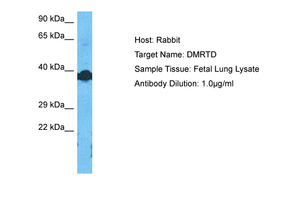 DMRTD Antibody (ARP39744_P050) in Human Fetal Lung using Western Blot