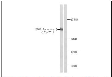 PDGF Receptor beta (Phospho-Tyr751) Antibody (OAEC00332) in NIH-3T3 using Western Blot