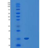 人LAIR-2/CD306重组蛋白C-6His