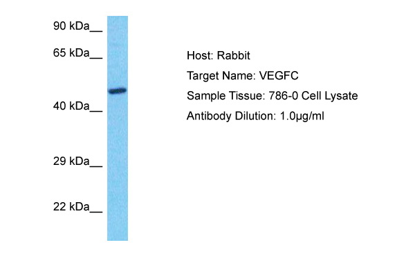 VEGFC Antibody (ARP74340_P050) in Human 786-0 Whole Cell using Western Blot