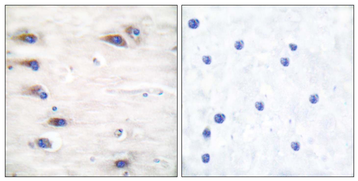 KSR Antibody (Phospho-Ser392) (OAAF07333) in Paraffin-embedded human brain using Immunohistochemistry