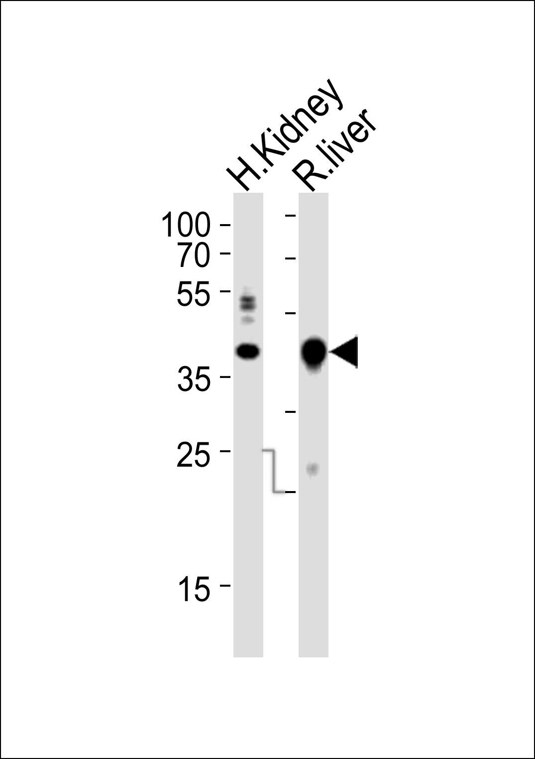 Ihh Antibody - C-terminal region (OAAB18848) in Human Kidney, rat liver tissue lysate using Western Blot