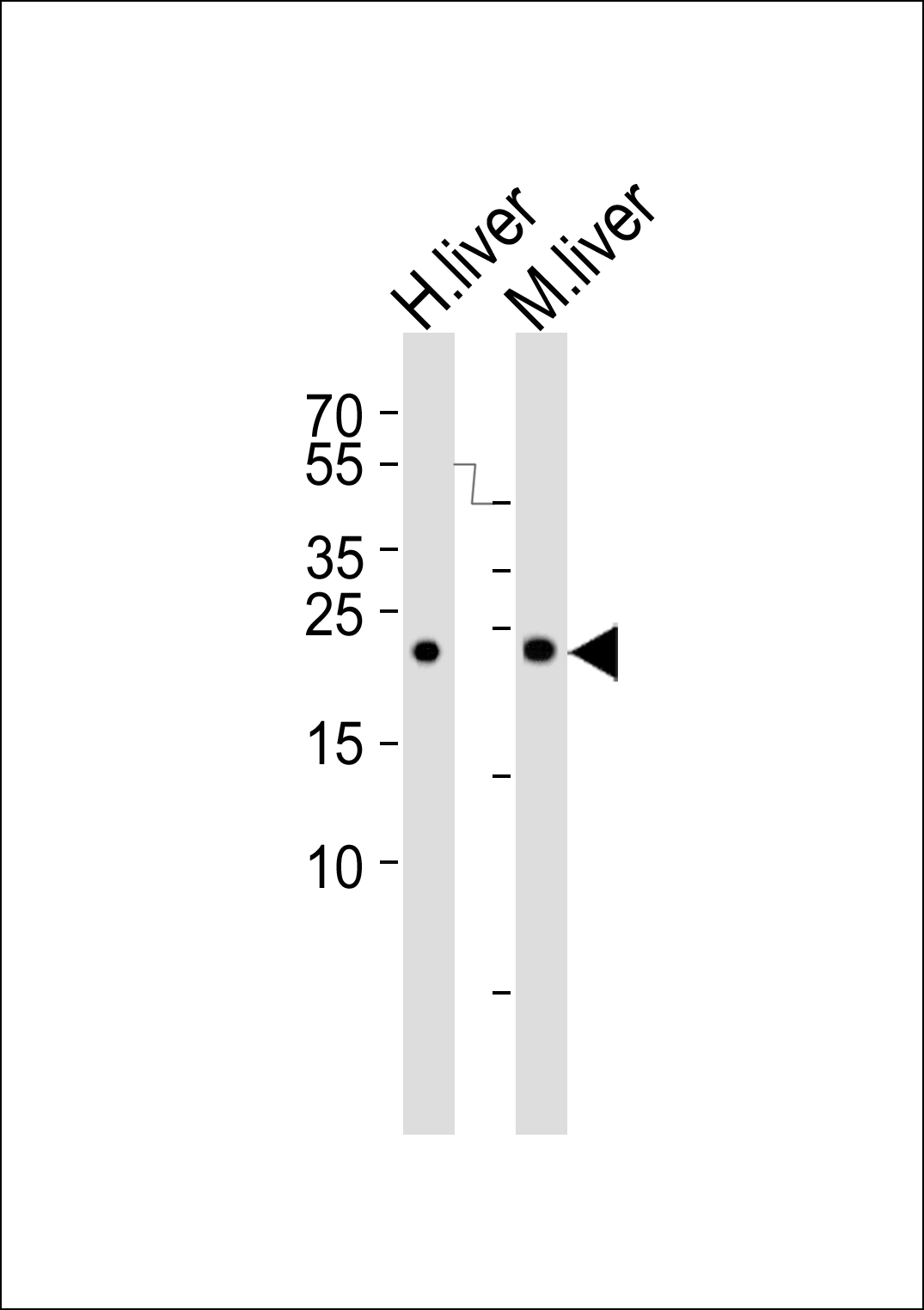 BLVRB Antibody - C-terminal (OAAB18150) in Human liver and mouse liver tissue lysate (from left to right) using Western Blot