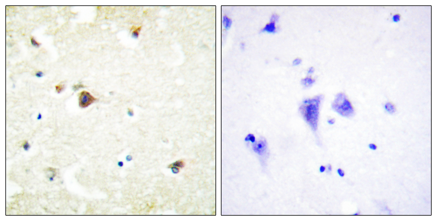 TRIM3 Antibody (OAAF02050) in human brain tissue using Immunohistochemistry.