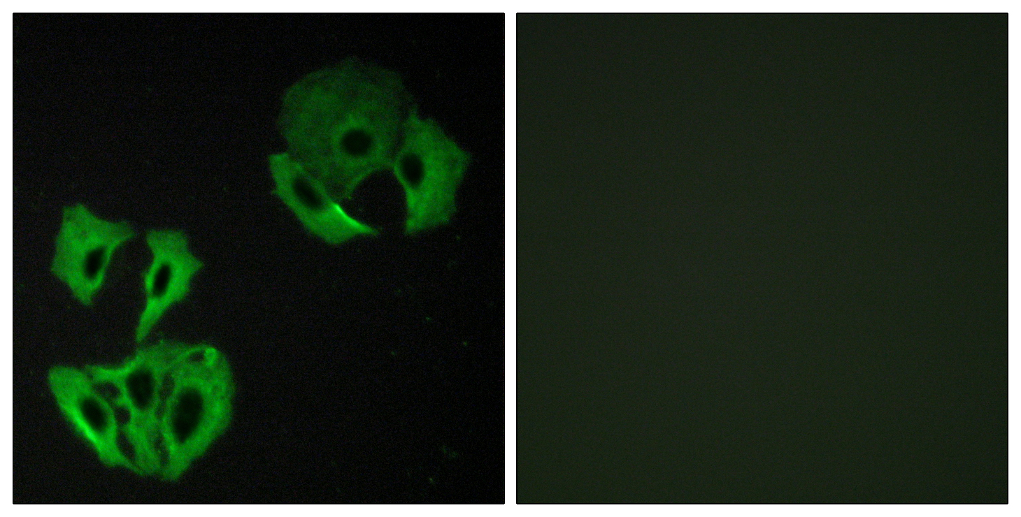 MADD Antibody (OAAF02577) in A549 using Immunofluorescence.