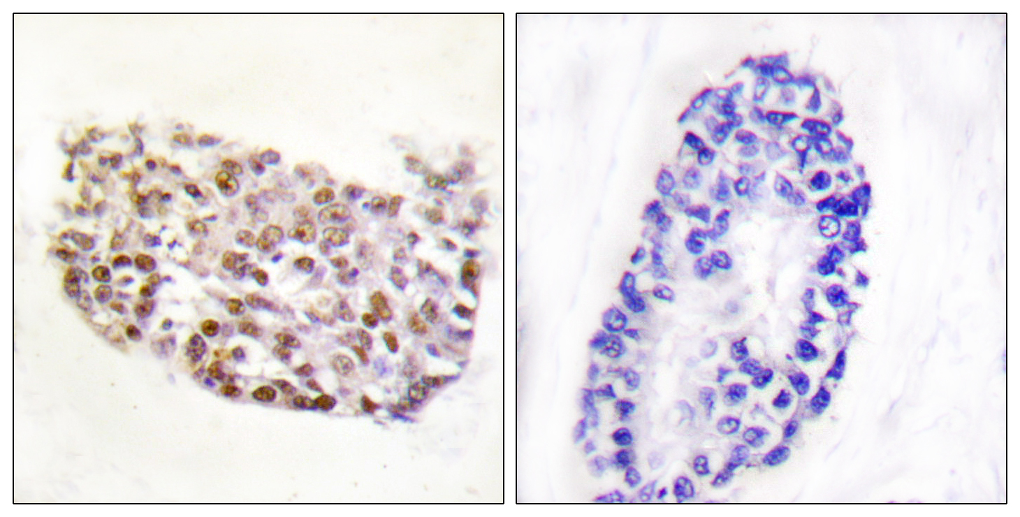 NFAT5 Antibody (OAAF01209) in human thyroid gland tissue using Immunohistochemistry.