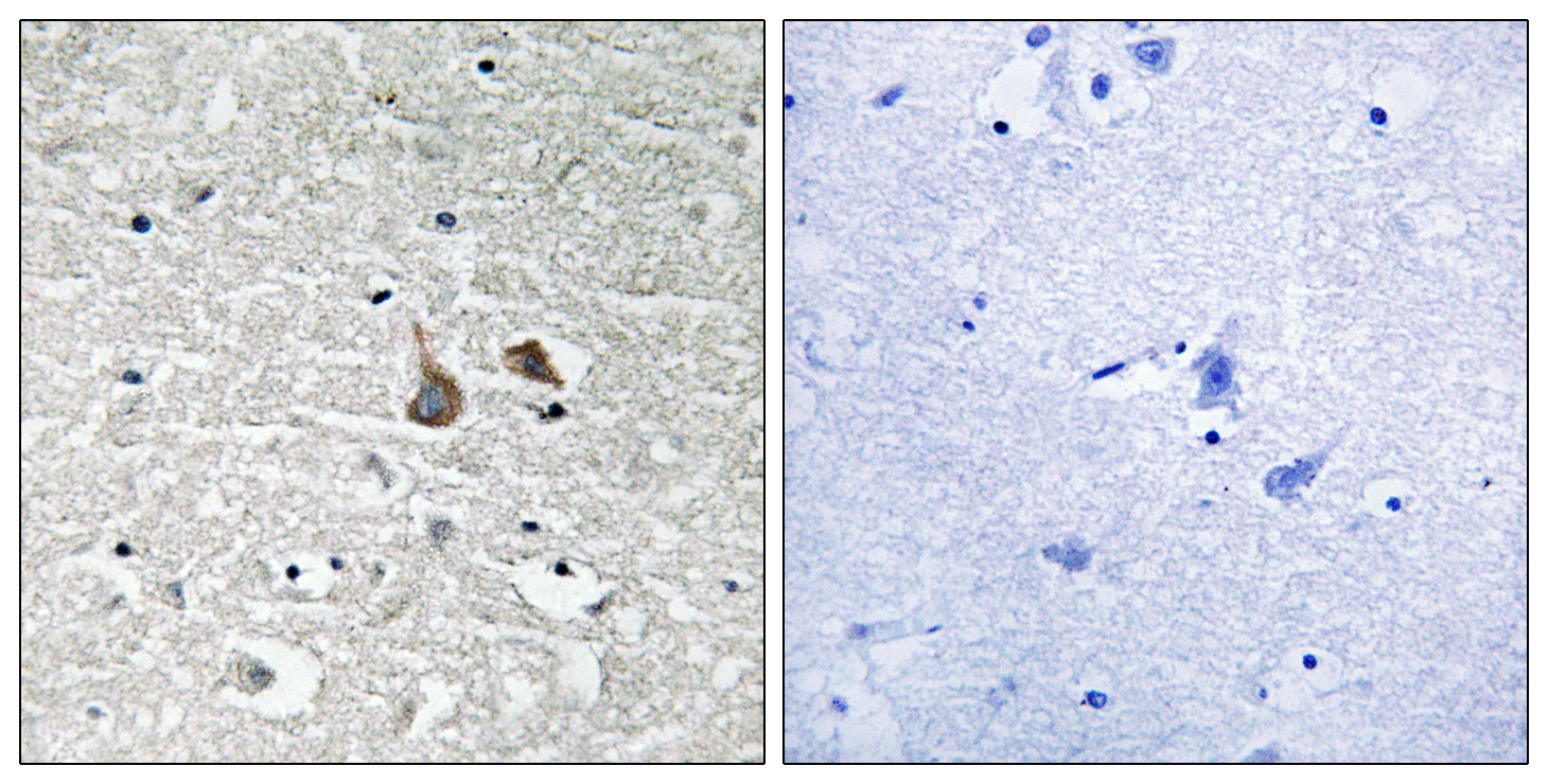 IRAK1 Antibody (Phospho-Ser376) (OAAF00447) in human brain using Immunohistochemistry.