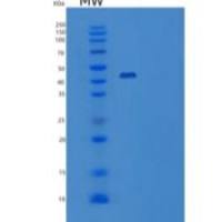 人CD147 / EMMPRIN / Basigin重组蛋白