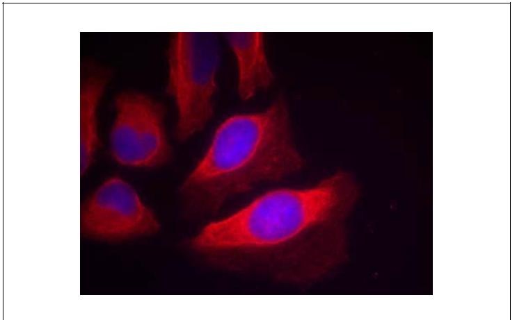 IKK- (Phospho-Tyr199) Antibody (OAEC00273) in Human Hela using Immunofluorescence