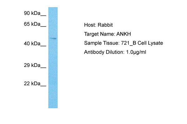 ANKH Antibody - C-terminal region (ARP74383_P050) in Human 721_B Whole Cell using Western Blot